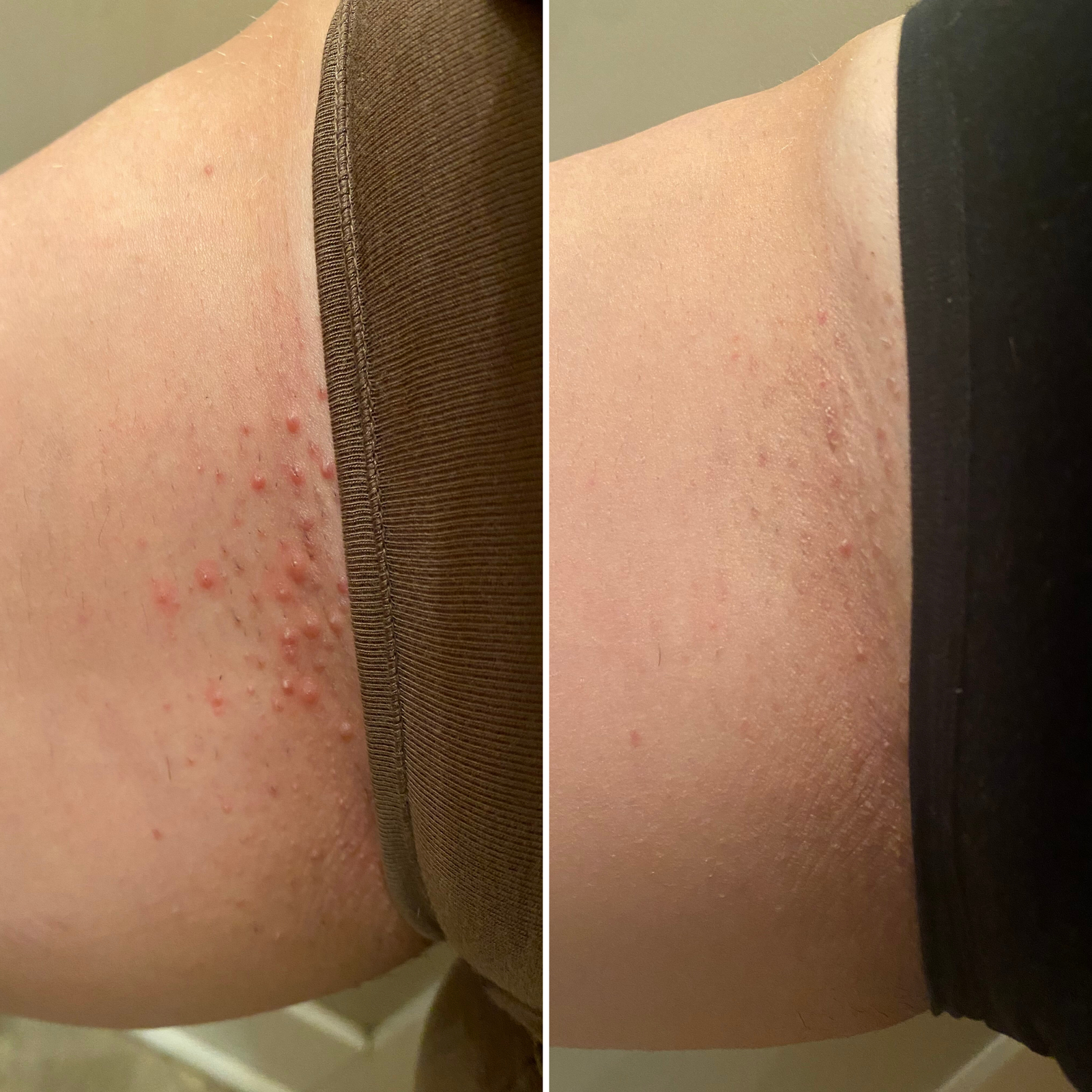 Bushbalm Ingrown Hair + Pre-Post Wax Oil (Nude)
