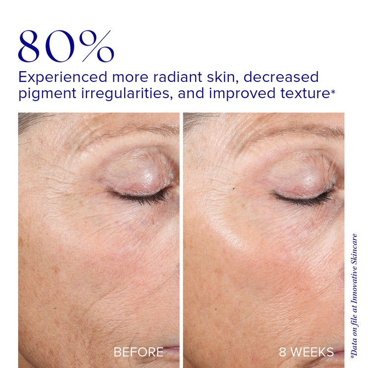 Active Peel System