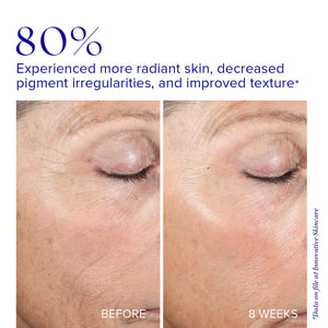 Active Peel System