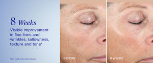 Active Peel System