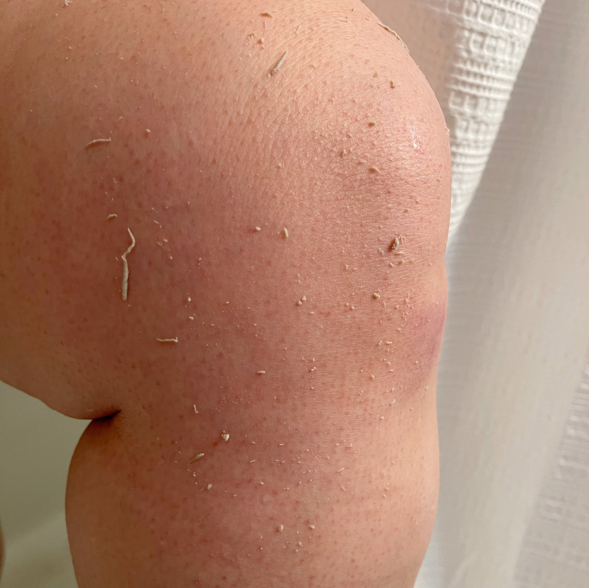 Elevate Esthetics Exfoliating  Body Mitt